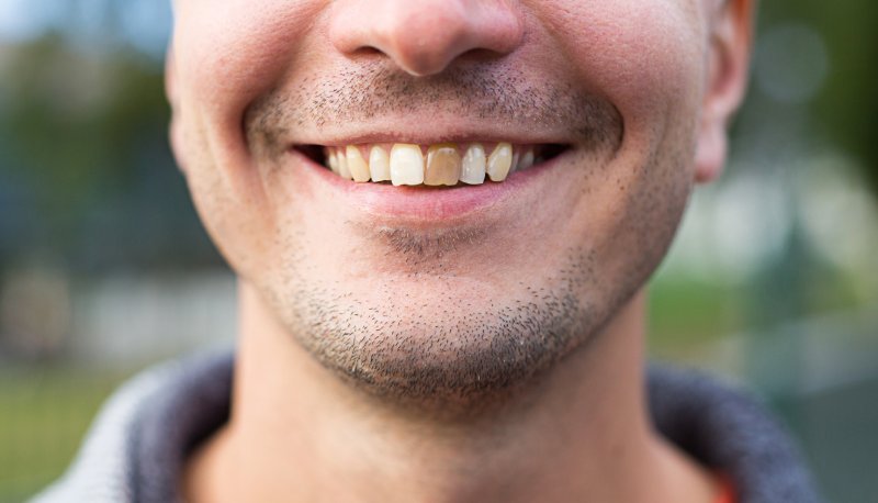 man with chipped tooth