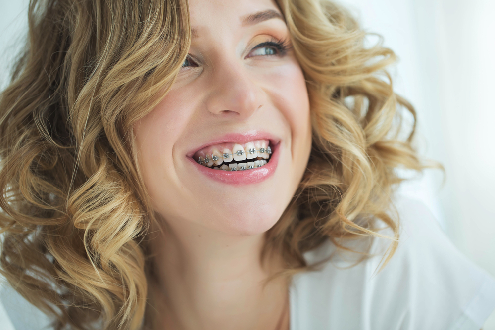 a white woman with braces